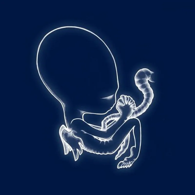 Sigur Ros